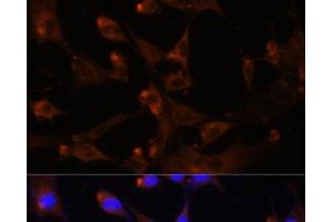 Immunofluorescence analysis of NIH-3T3 cells using CAD Polyclonal Antibody at dilution of 1:100. (CAD Antikörper)