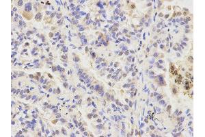 Immunohistochemistry (IHC) image for anti-Autophagy related 4A Cysteine Peptidase (ATG4A) antibody (ABIN1871138) (ATG4A Antikörper)