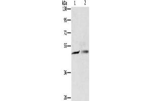 Gel: 8 % SDS-PAGE, Lysate: 40 μg, Lane 1-2: A549 cells, A375 cells, Primary antibody: ABIN7130597(PGBD4 Antibody) at dilution 1/250, Secondary antibody: Goat anti rabbit IgG at 1/8000 dilution, Exposure time: 5 seconds (PGBD4 Antikörper)