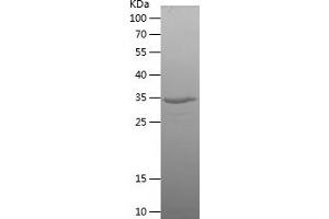 Western Blotting (WB) image for Small Nuclear Ribonucleoprotein Polypeptide N (SNRPN) (AA 73-173) protein (His-IF2DI Tag) (ABIN7287356) (SNRPN Protein (AA 73-173) (His-IF2DI Tag))