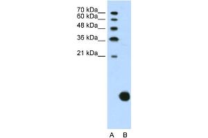 WB Suggested Anti-RPS29 Antibody Titration:  1. (RPS29 Antikörper  (N-Term))