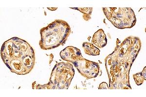 Immunohistochemistry (IHC) image for anti-Transferrin (TF) (AA 361-683) antibody (ABIN7429184)