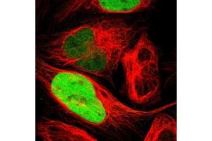Immunofluorescent staining of U-2 OS with TPX2 polyclonal antibody  (Green) shows positivity in nucleus but excluded from the nucleoli. (TPX2 Antikörper)