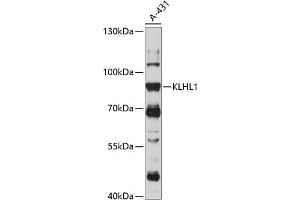 Western blot analysis of extracts of A-431 cells, using KLHL1 antibody (ABIN7268077) at 1:1000 dilution. (KLHL1 Antikörper  (AA 1-210))