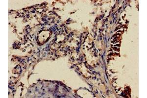 Immunohistochemistry of paraffin-embedded human lung tissue using ABIN7158098 at dilution of 1:100 (SHoc2/Sur8 Antikörper  (AA 3-89))