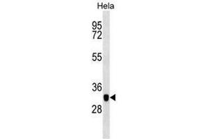 Western blot analysis in Hela cell line lysates (35µg/lane) using CAPG Antibody . (CAPG Antikörper  (Middle Region))