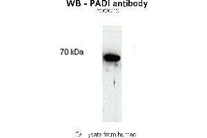 Image no. 1 for anti-Peptidyl Arginine Deiminase, Type II (PADI2) antibody (ABIN346986) (PADI2 Antikörper)