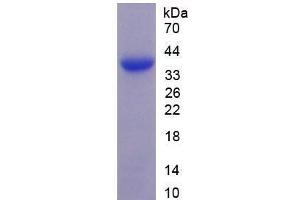 Image no. 1 for Microfibrillar Associated Protein 2 (MFAP2) (AA 6-162) (Active) protein (His tag) (ABIN6239901) (MFAP2 Protein (AA 6-162) (His tag))