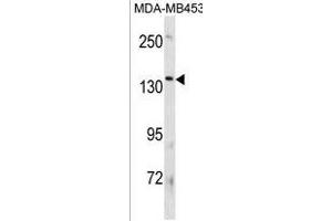 ATP8B3 Antibody (N-term) (ABIN1881094 and ABIN2839049) western blot analysis in MDA-M cell line lysates (35 μg/lane). (ATP8B3 Antikörper  (N-Term))