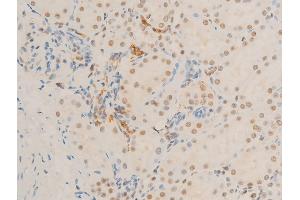 ABIN6267271 at 1/100 staining rat kidney tissue sections by IHC-P. (c-MYC Antikörper  (pSer62))