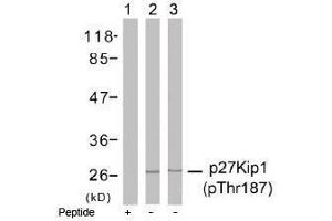 Image no. 1 for anti-Cyclin-Dependent Kinase Inhibitor 1B (p27, Kip1) (CDKN1B) (pThr187) antibody (ABIN196947) (CDKN1B Antikörper  (pThr187))
