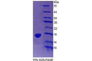 SDS-PAGE (SDS) image for Protein Tyrosine Phosphatase, Mitochondrial 1 (PTPMT1) (AA 71-197) protein (His tag) (ABIN6239280)