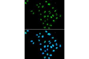 Immunofluorescence analysis of MCF-7 cells using EIF6 antibody.