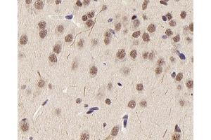 Immunohistochemistry analysis of paraffin-embedded rat brain using HDAC1 Polyclonal Antibody at dilution of 1:300. (HDAC1 Antikörper)