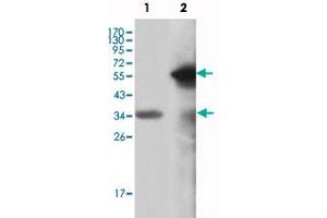 Western blot analysis using MLL monoclonal antibody, clone 10F8D7  against truncated MLL recombinant protein (1) and truncated GFP-MLL(aa 3714-3969) transfected COS-7 cell lysate (2). (MLL/KMT2A Antikörper)