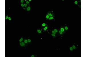 Immunofluorescence staining of Hela cells with ABIN7139609 at 1:5, counter-stained with DAPI. (HIST1H2AG Antikörper  (meLys9))