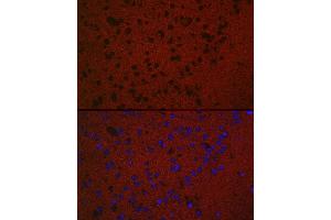 Immunofluorescence analysis of Mouse brain using RA antibody (ABIN7269809) at dilution of 1:50. (RAB3A Antikörper  (AA 100-200))