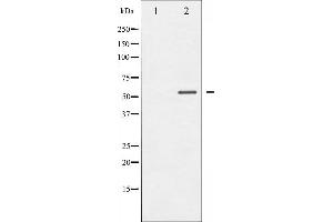 Western blot analysis of MEF2A phosphorylation expression in UV treated K562 whole cell lysates,The lane on the left is treated with the antigen-specific peptide. (MEF2A Antikörper  (pThr319))