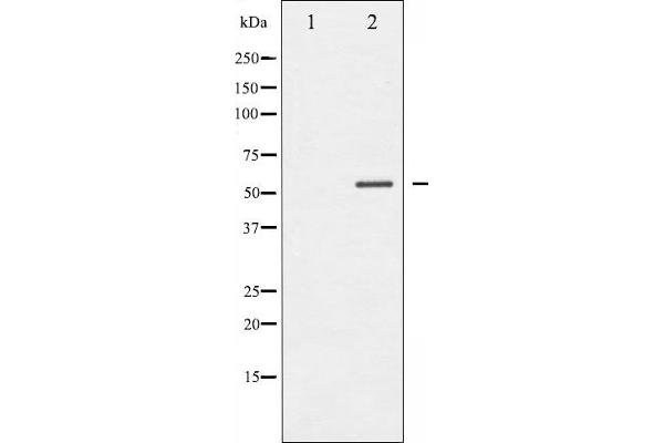 MEF2A antibody  (pThr319)