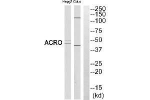 Western blot analysis of extracts from HEPG2 cells and COLO cells, using ACRO (heavy chain, Cleaved-Ilantibody. (Acrosin Antikörper  (Cleaved-Ile43, Heavy Chain))