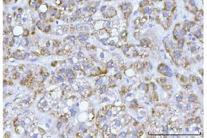 IHC analysis of Hamartin/TSC1 using anti-Hamartin/TSC1 antibody (ABIN7599499). (TSC1 Antikörper  (AA 1-618))