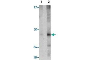 Western blot analysis of rat liver tissue with NR1H3 polyclonal antibody  at (Lane 1) 1 and (Lane 2) 2 ug/mL dilution. (NR1H3 Antikörper  (N-Term))