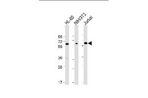 All lanes : Anti-ME2 Antibody (C-term) at 1:4000 dilution Lane 1: HL-60 whole cell lysate Lane 2: NIH/3T3 whole cell lysate Lane 3: Jurkat whole cell lysate Lysates/proteins at 20 μg per lane. (NAD-ME Antikörper  (C-Term))