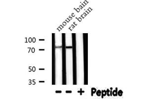 Western blot analysis of PRKCG expression in various lysates (PKC gamma Antikörper  (Internal Region))