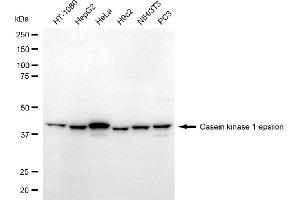 Western blotting analysis using casein kinase 1 epsilon antibody (ABIN7797881). (CK1 epsilon Antikörper)