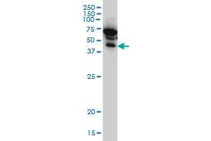 IKBKG monoclonal antibody (M02), clone 1D4 Western Blot analysis of IKBKG expression in HeLa .