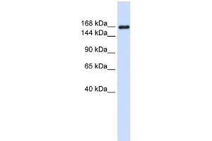 WB Suggested Anti-LAMC1 Antibody Titration: 0. (Laminin gamma 1 Antikörper  (Middle Region))