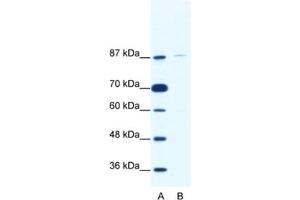 Western Blotting (WB) image for anti-TATA Box Binding Protein (TBP)-Associated Factor, RNA Polymerase I, C, 110kDa (TAF1C) antibody (ABIN2461762)