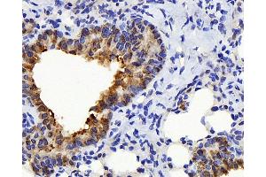 Immunohistochemistry analysis of paraffin-embedded mouse lung using TSC22D3 Polyclonal Antibody at dilution of 1:300. (TSC22D3 Antikörper)