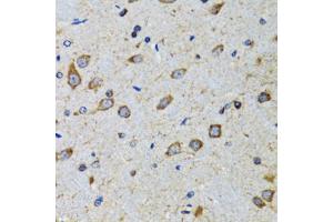 Immunohistochemistry of paraffin-embedded mouse brain using CDK1 antibody. (CDK1 Antikörper)