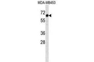 STEAP3 Antibody (C-term) western blot analysis in MDA-MB453 cell line lysates (35µg/lane). (STEAP3 Antikörper  (C-Term))