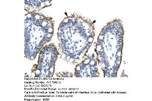 Human Intestine (FLJ20729 (C-Term) Antikörper)