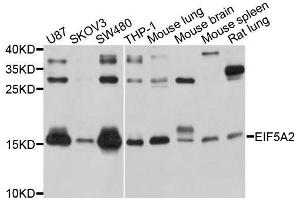 Western blot analysis of extracts of various cell lines, using EIF5A2 antibody. (EIF5A2 Antikörper  (AA 1-153))