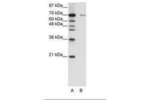 Image no. 1 for anti-Zinc Finger Protein 398 (ZNF398) (C-Term) antibody (ABIN6736187) (ZNF398 Antikörper  (C-Term))