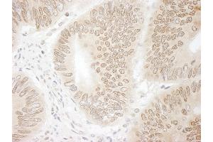 anti-Denticleless E3 Ubiquitin Protein Ligase Homolog (DTL) (C-Term) antibody