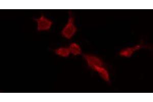 ABIN6275659 staining HepG2 by IF/ICC. (USP45 Antikörper  (Internal Region))