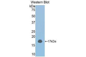 Western Blotting (WB) image for anti-Janus Kinase 2 (JAK2) (AA 689-807) antibody (ABIN1176457) (JAK2 Antikörper  (AA 689-807))