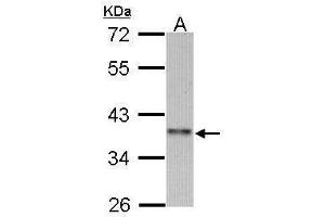 WB Image Sample (30 ug of whole cell lysate) A: 293T 10% SDS PAGE antibody diluted at 1:1000 (CCNI2 Antikörper)