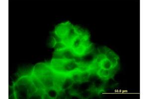 Immunofluorescence of purified MaxPab antibody to CALCR on 293 cell.