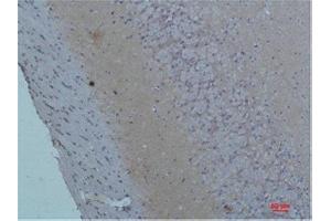 Immunohistochemistry (IHC) analysis of paraffin-embedded Rat Brain Tissue using S100 Rabbit Polyclonal Antibody diluted at 1:200. (S100A1 Antikörper)
