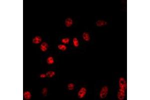 Immunofluorescent analysis of Cullin 2 staining in NIH3T3 cells. (Cullin 2 Antikörper  (C-Term))