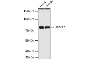 Western blot analysis of extracts of various cell lines, using TRIM47 antibody (ABIN7270991) at 1:1000 dilution. (TRIM47 Antikörper  (AA 356-530))
