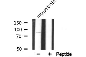 Western blot analysis on mouse brain lysate using Integrin beta-5 Antibody. (Integrin beta 5 Antikörper  (C-Term))