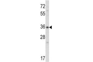 Western blot analysis of Connective Tissue Growth Factor antibody and NCI-H460 lysate. (CTGF Antikörper  (AA 315-349))
