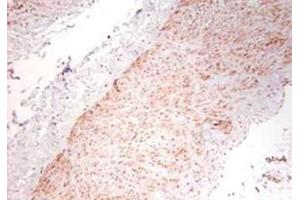 Image no. 1 for anti-Tumor Necrosis Factor alpha (TNF alpha) antibody (ABIN799618) (TNF alpha Antikörper)