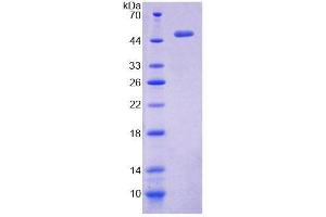 SDS-PAGE (SDS) image for Periphilin 1 (PPHLN1) (AA 1-381) protein (His tag) (ABIN6238735)